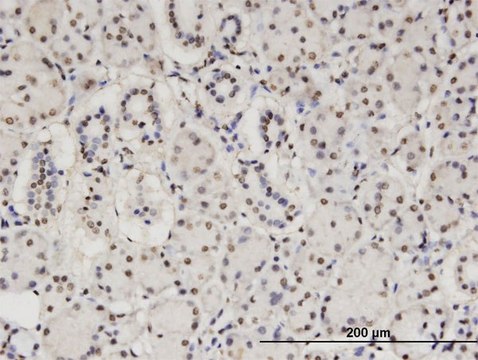 Monoclonal Anti-CBFA2T2 antibody produced in