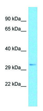 Anti-SRRM2 (C-terminal) antibody produced in