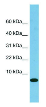 Anti-FABP1 (N-terminal) antibody produced in