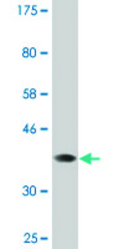Monoclonal Anti-SLC28A2 antibody produced in