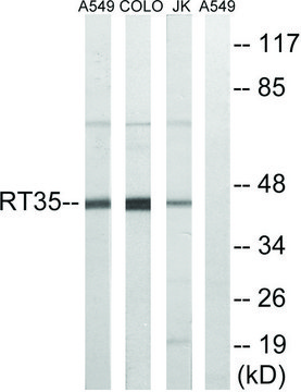 Anti-MRPS35 antibody produced in rabbit