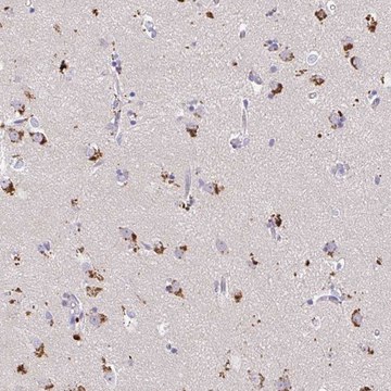 Anti-MAP1LC3A antibody produced in rabbit