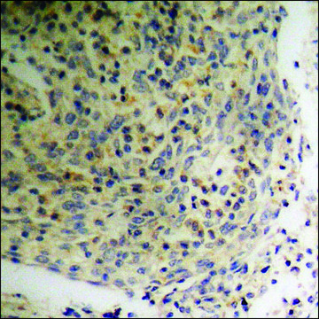Anti-phospho-p47 phox (pSer³??) antibody produced