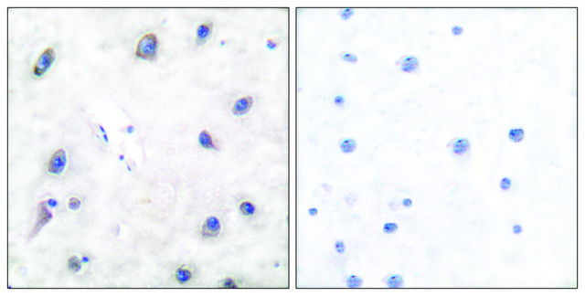 Anti-DARPP-32, N-Terminal antibody produced in