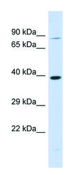 Anti-RHBDL2 (N-terminal) antibody produced in
