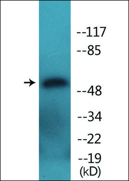 Anti-phospho-ATF2 (pSer???) antibody produced in