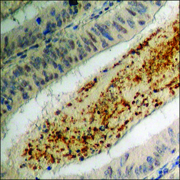 Anti-phospho-MEF2D (pSer???) antibody produced in
