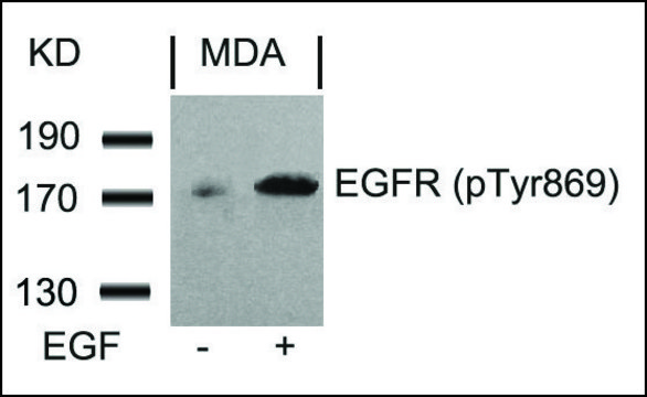 Anti-phospho-EGFR (pTyr???) antibody produced in