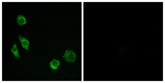 Anti-GPRC5D antibody produced in rabbit
