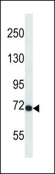 ANTI-MOUSE FGFR3 (CENTER) antibody produced