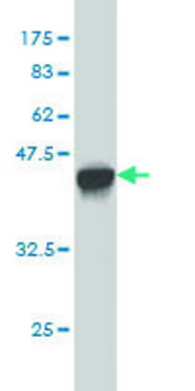 Monoclonal Anti-GAA antibody produced in