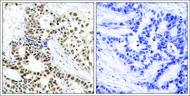 Anti-phospho-BRCA1 (pSer¹?²³) antibody produced in