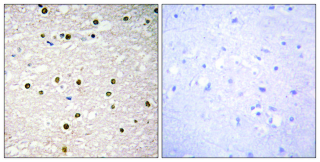 Anti-P73 antibody produced in rabbit