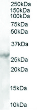 Anti-MBL2 antibody produced in goat