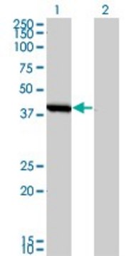 Monoclonal Anti-SMS antibody produced in