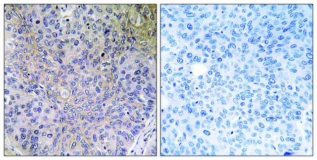 Anti-NDUFS7 antibody produced in rabbit