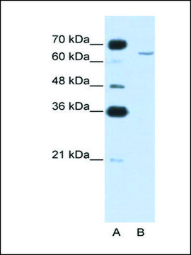 Anti-CPEB2 antibody produced in rabbit