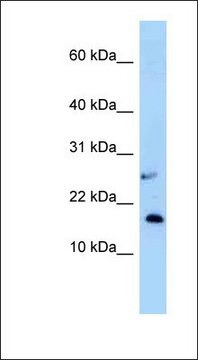 Anti-NUDT15 antibody produced in rabbit