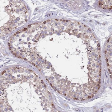 Anti-CMTR2 antibody produced in rabbit