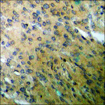 Anti-phospho-BID (pSer??) antibody produced in