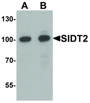 Anti-SIDT2 antibody produced in rabbit