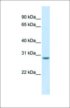 Anti-MARCH8 antibody produced in rabbit