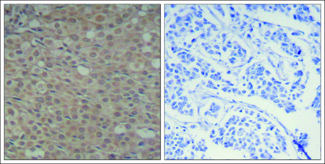 Anti-phospho-SMAD3 (pSer?²?) antibody produced in