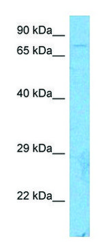 Anti-CUL3 (C-terminal) antibody produced in