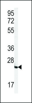 ANTI-FOLR2(N-TERMINAL) antibody produced in rabbit