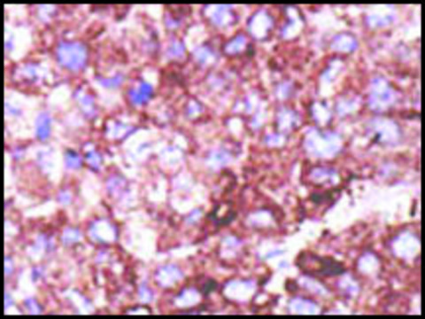 Anti-UEV (N-term) antibody produced in