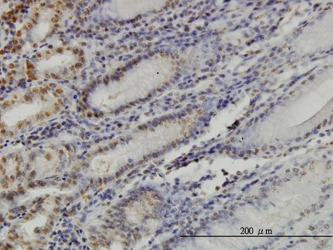 ANTI-YY1 antibody produced in mouse