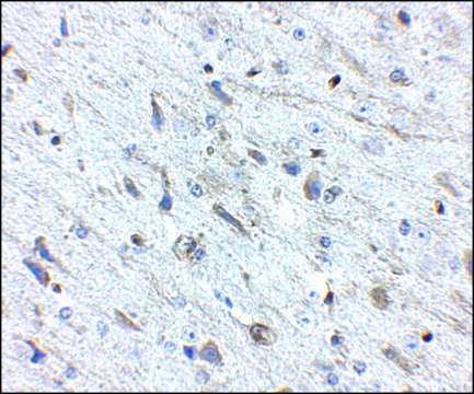 Anti-FKBP15 antibody produced in rabbit