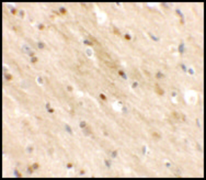 Anti-TMEM59L antibody produced in rabbit