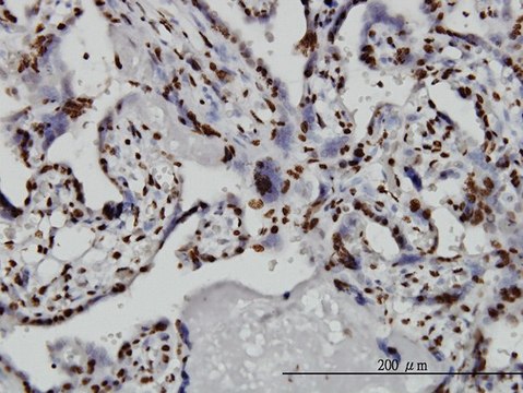 ANTI-TAF11 antibody produced in mouse