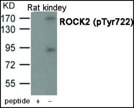 Anti-phospho-ROCK2 (pTyr?²²) antibody produced in