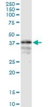 Monoclonal Anti-LONRF1, (N-terminal) antibody produced