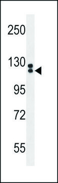 ANTI-TTLL13 (CENTER) antibody produced in