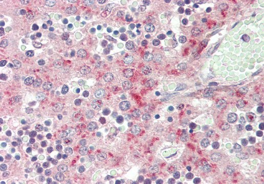 Anti-F13B antibody produced in rabbit