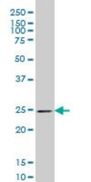 ANTI-PSPH antibody produced in mouse