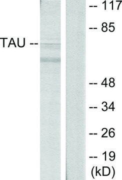 Anti-TAU antibody produced in rabbit