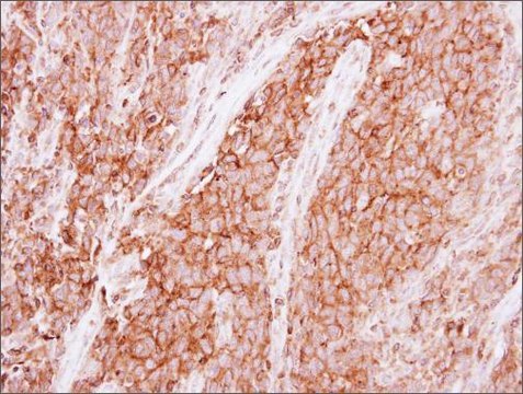 Anti-GNB1 antibody produced in rabbit