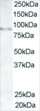 Anti-AKAP3/SOB1 antibody produced in goat